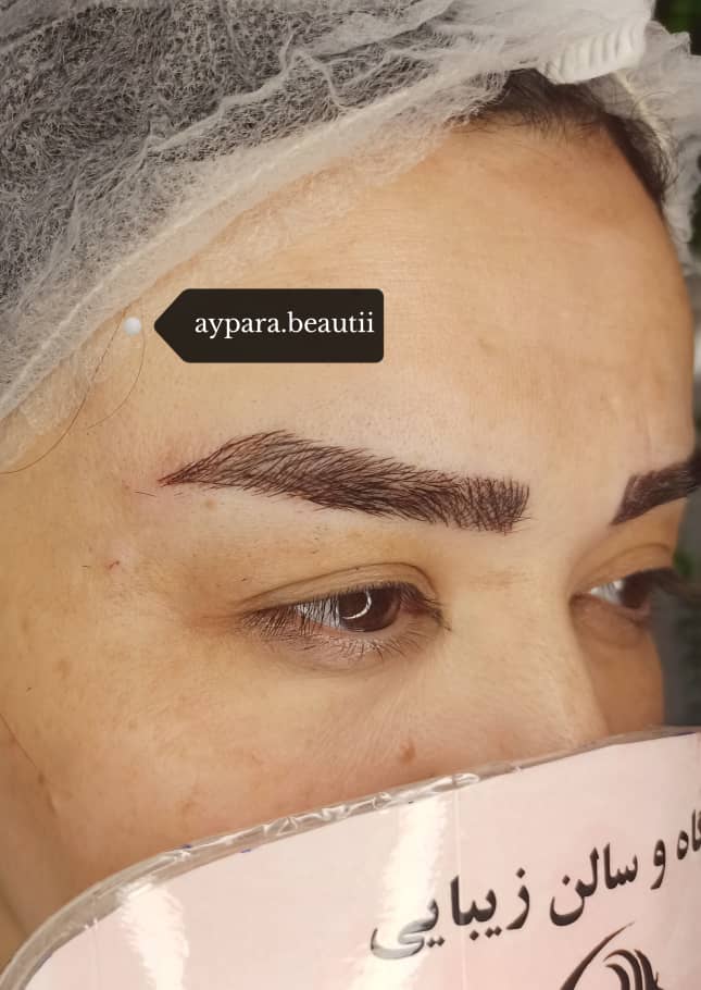 فیبروز ابرو